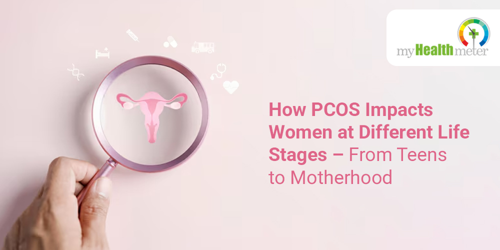 How PCOS Impacts Women at Different Life Stages – From Teens to Motherhood